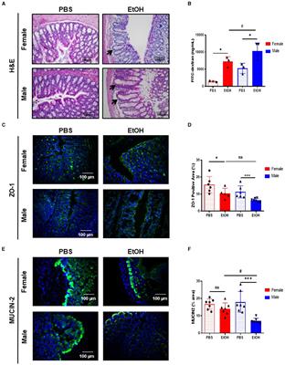 Fecal microbiota transplantation from female donors restores gut permeability and reduces liver injury and inflammation in middle-aged male mice exposed to alcohol